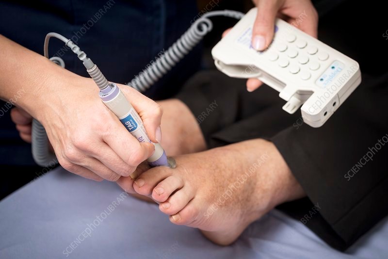 VPT, Doppler (foot)