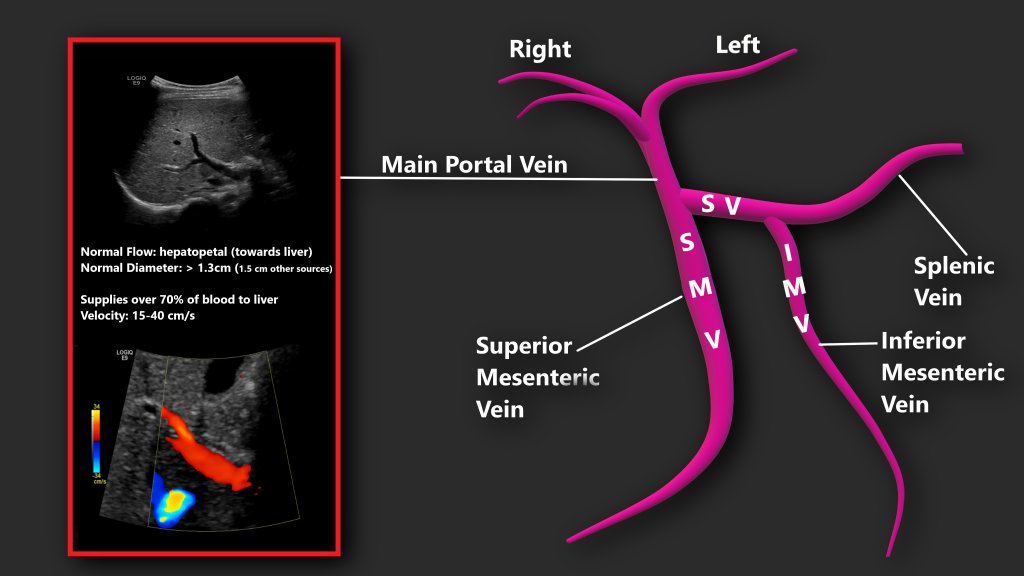 Portal Venous Doppler