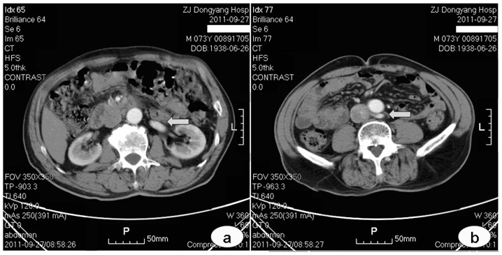 Arterial / Venous (R/L)