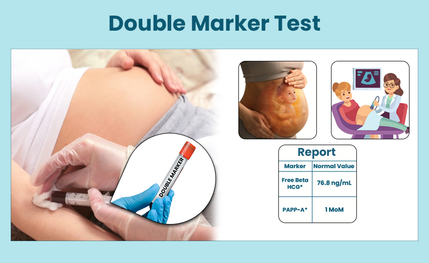 NT Scan with Double Marker Screening (12-14 Weeks)