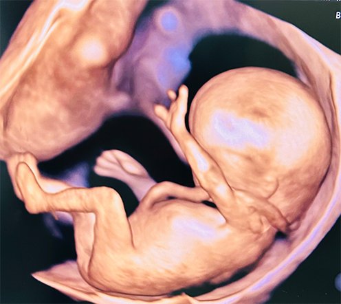 Anomaly 3D/4D/HD Live