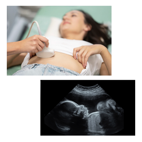 Growth Scan Fetal Doppler