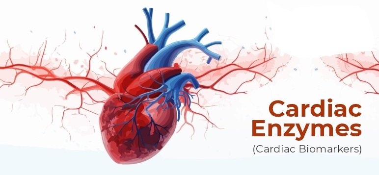Cardiac Enzymes